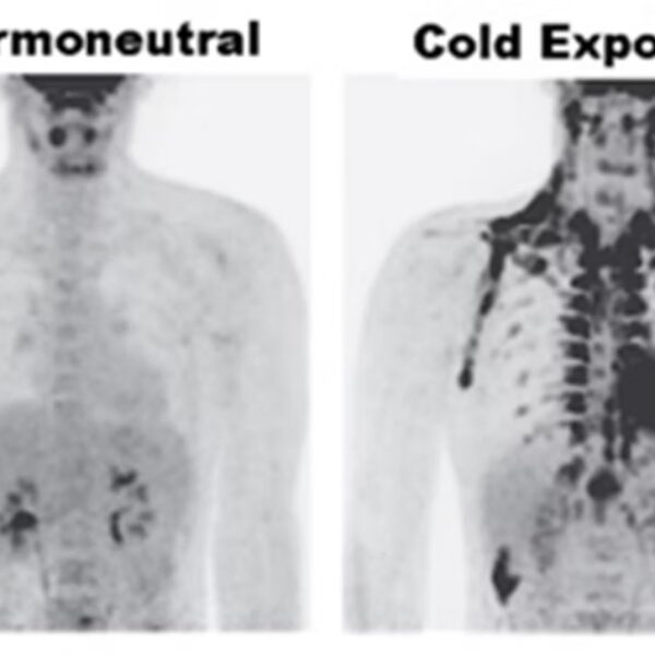 Passer votre corps en mode hiver