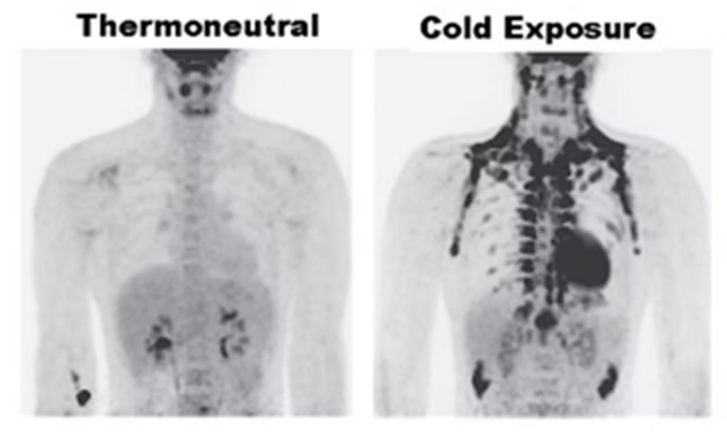 Read more about the article Passer en mode hiver